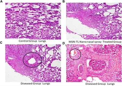 Designing of SiO2 mesoporous nanoparticles loaded with mometasone furoate for potential nasal drug delivery: Ex vivo evaluation and determination of pro-inflammatory interferon and interleukin mRNA expression